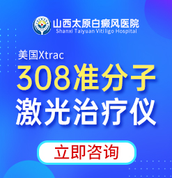 太原白癜风医院：308 准分子激光助力白斑治疗