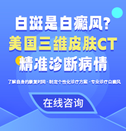 太原白癜风医院引进皮肤 CT 检测仪，精准诊断助力祛白
